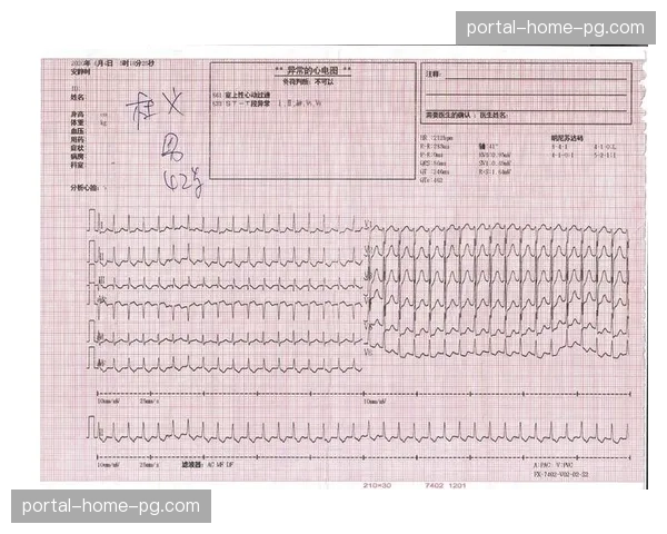 球探报告趋势：俱乐部对中后卫的“防守决策速度”评估权重超过“纯速度”
